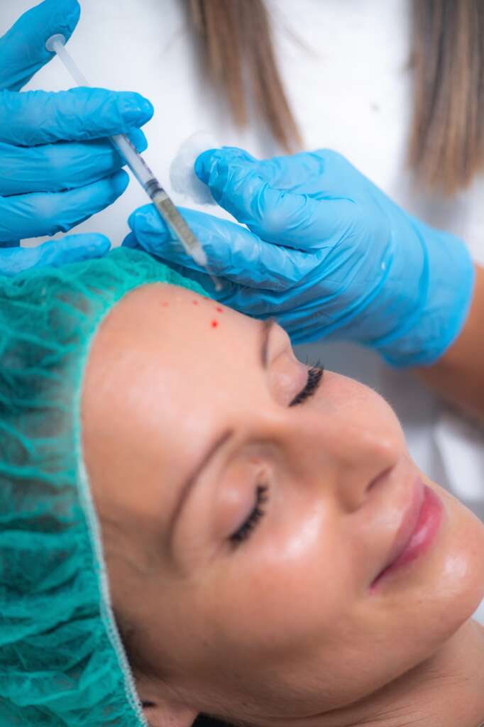 PRP or Platelet Rich Plasma Cosmetic Face Treatment